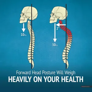 Forward Head Posture Will Weight Heavily on Your Health